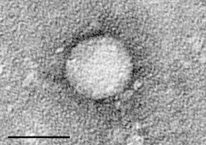 Hepatitis C virus particle as viewed by electron microscopy. Scale = 50nm. (Catanese et al., 2013)
