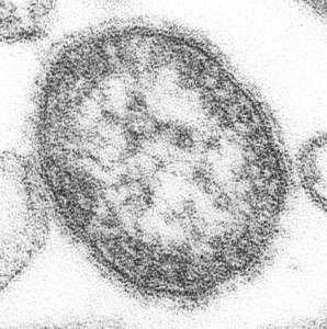 Measles virus particle (EM). By Photo Credit: Cynthia S. Goldsmith Content Providers(s): CDC/ Courtesy of Cynthia S. Goldsmith; William Bellini, Ph.D. [Public domain], via Wikimedia Commons